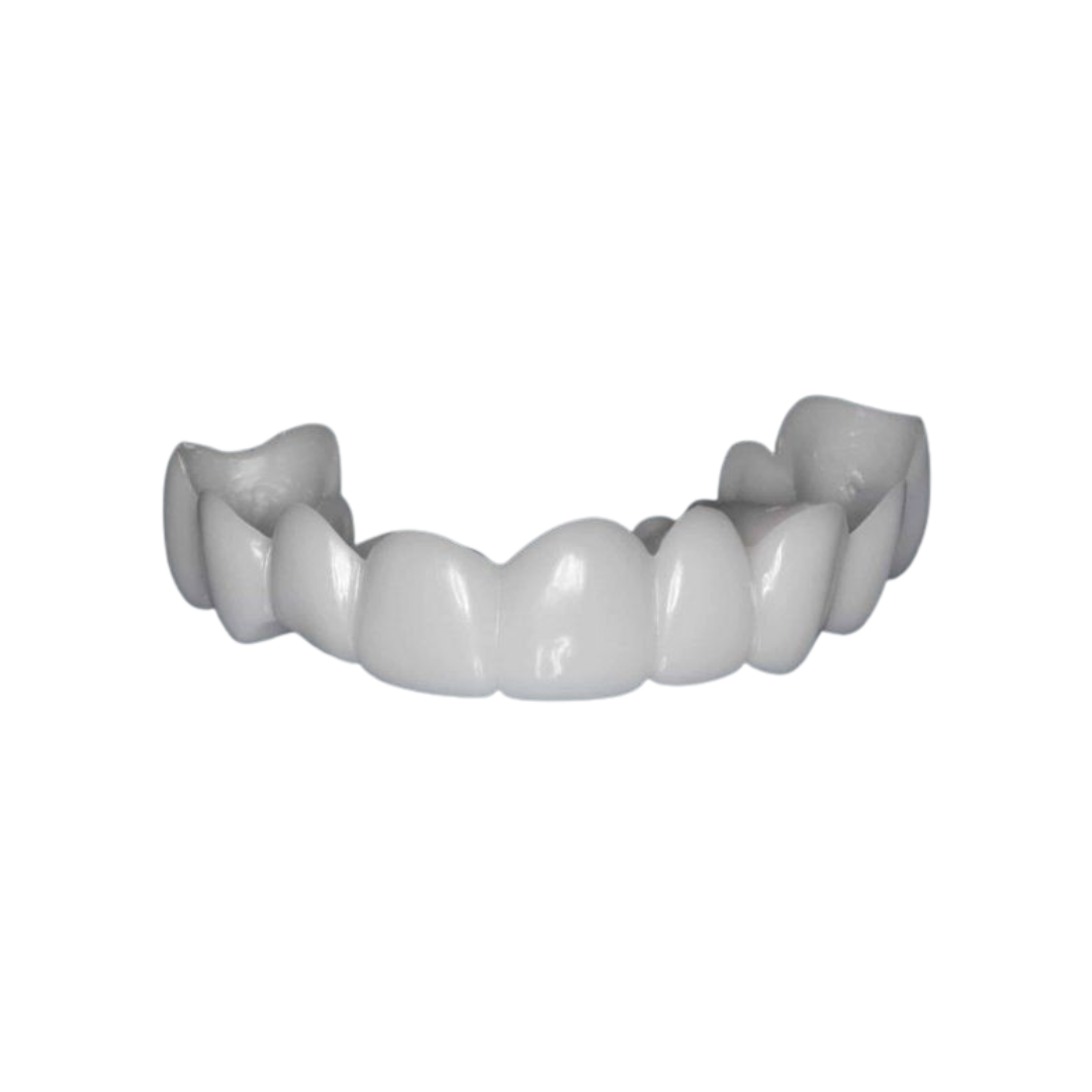 LumiLid™ Snap-On Veneers
