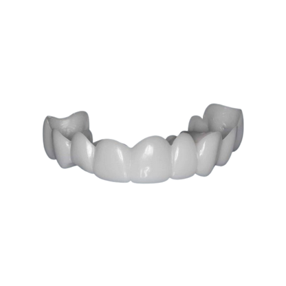 LumiLid™ Snap-On Veneers