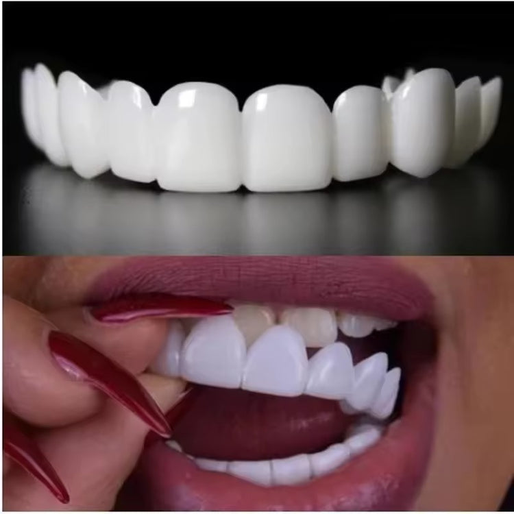 LumiLid™ Snap-On Veneers