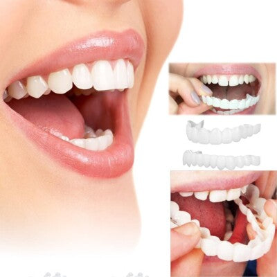 LumiLid™ Snap-On Veneers